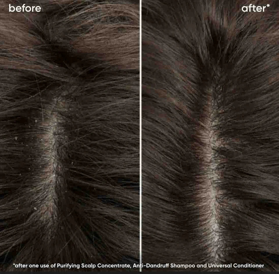 BIOLAGE SCALP SYNC PURIFYNG SCALP CONCENTRATE 200ML