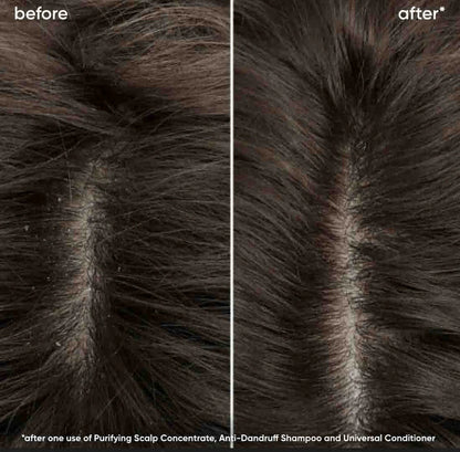 BIOLAGE SCALP SYNC PURIFYNG SCALP CONCENTRATE 200ML