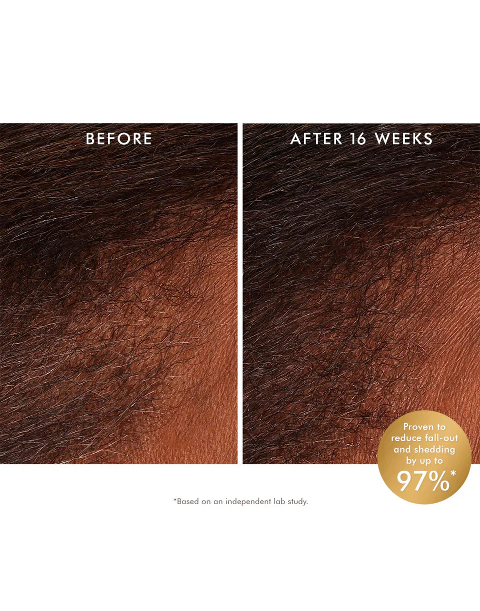 MOROCCANOIL SCALP REVITALIZING TONICO 100 ML